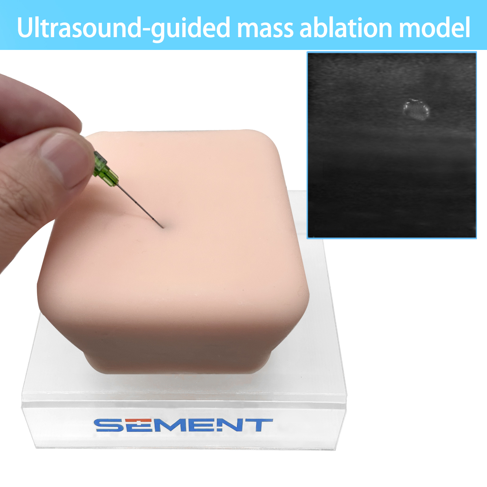 Ultrasound Guided Tumor Ablati – обзор и цена Medical Lab Ultrasound