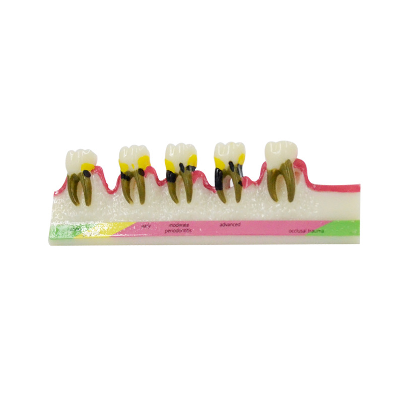 Periodontal Disease Model Dent – обзор и цена Medical Lab Study