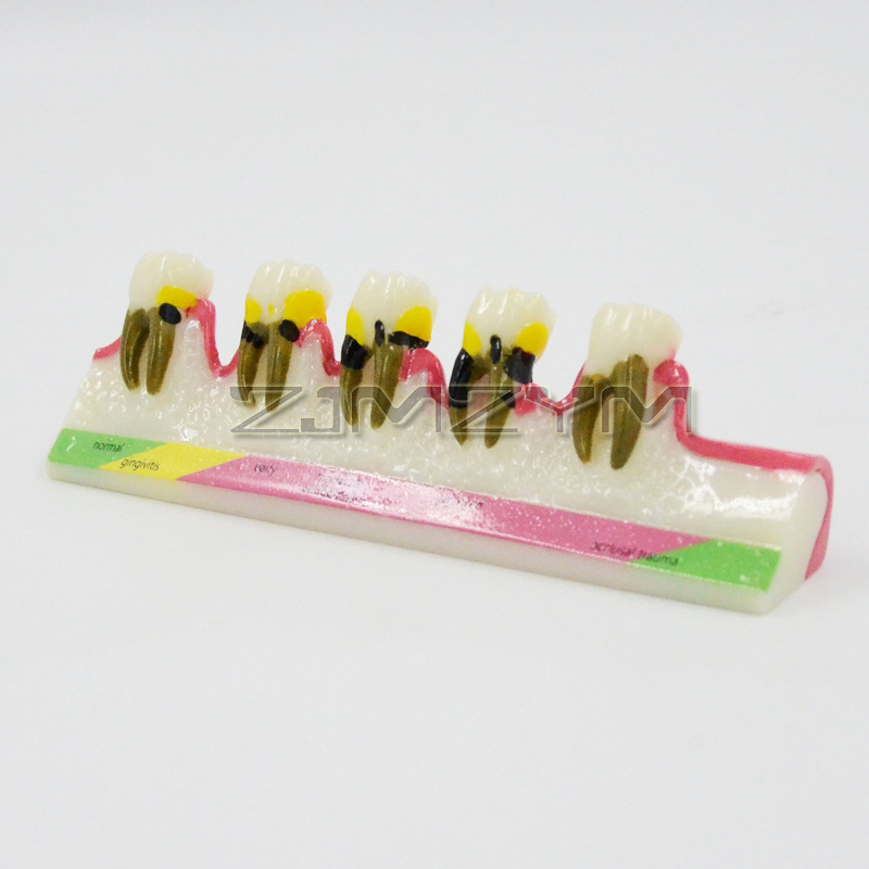 Periodontal Disease Model Dent – обзор и цена Medical Lab Study
