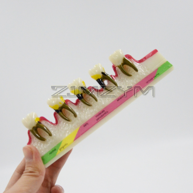 Periodontal Disease Model Dent – обзор и цена Medical Lab Study