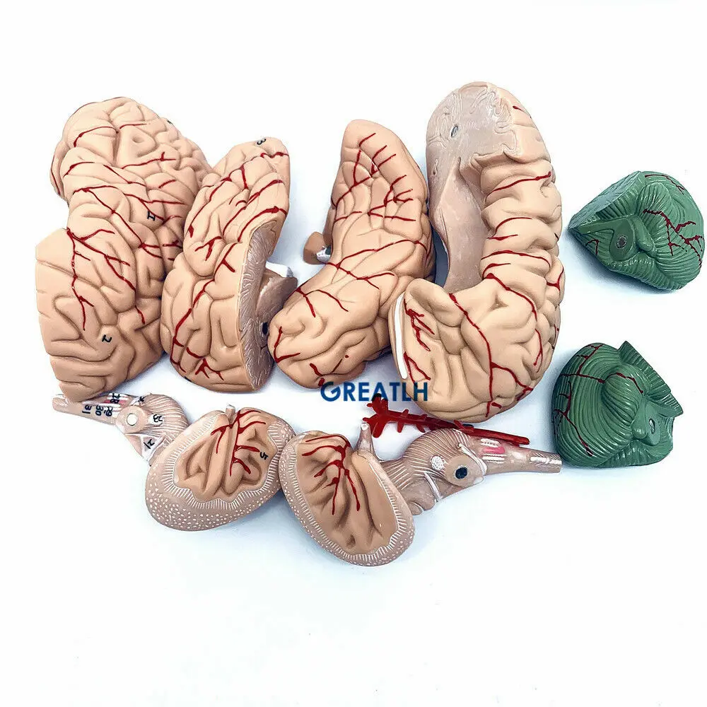 GREATLH Brain Anatomical Model – обзор и цена Medical Lab Study